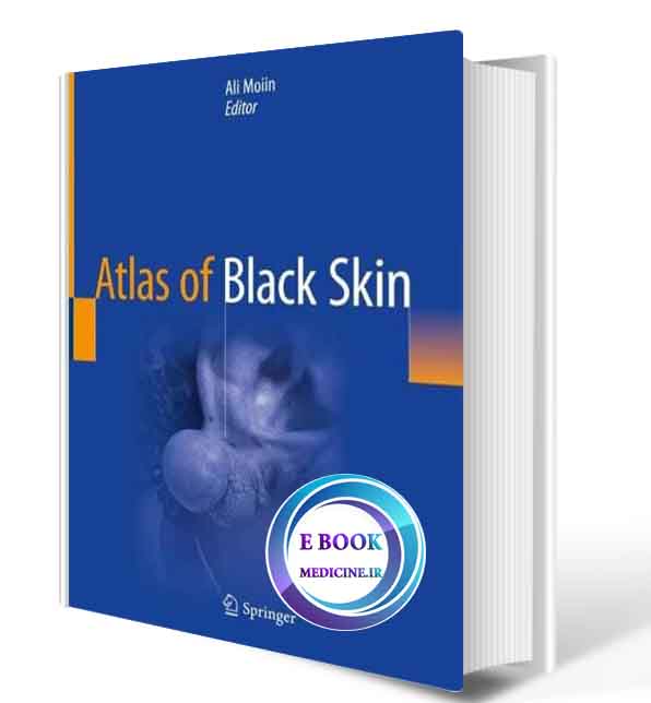 دانلود کتاب Atlas of Black Skin  2020  (ORIGINAL PDF)